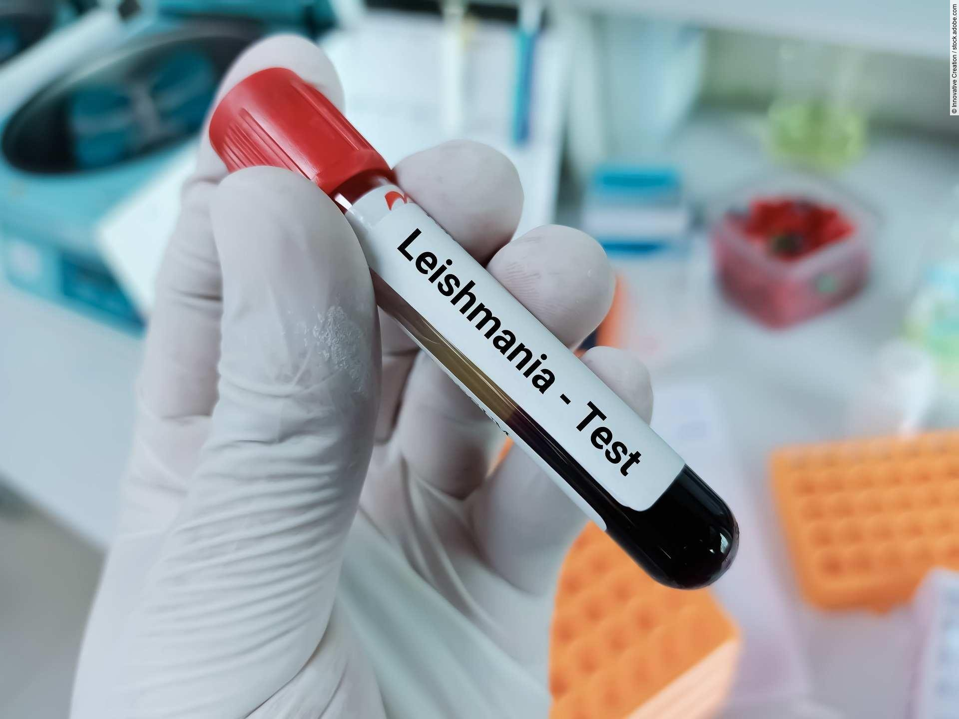 Blood sample for Leishmania parasite test, leishmaniasis. Medica