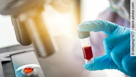 lab technician assistant analyzing a blood sample in test tube a